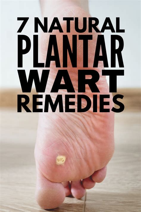 Home Remedies that Work: 7 Natural Treatments for Plantar Warts