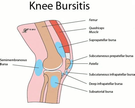 What Causes Knee Pain When Bending & How To Fix It - Gymless