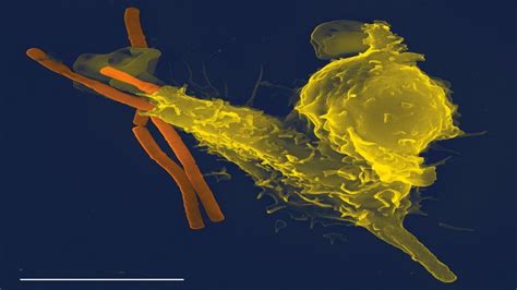 The Layout of the Immune System - thedailynewspapers