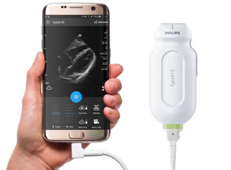 Best Portable Ultrasound Machine For Home Use | Review Home Co