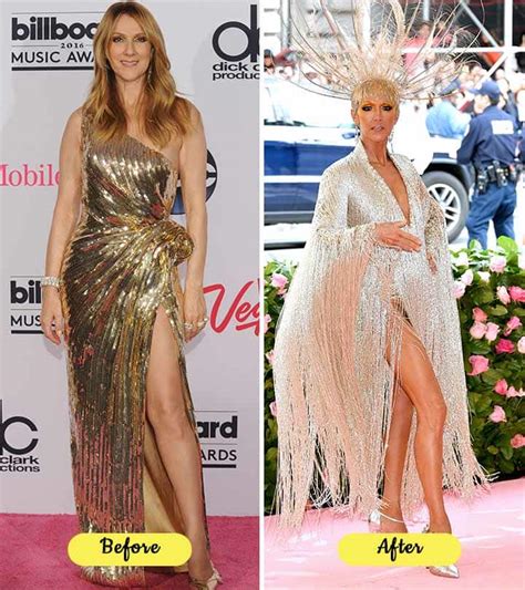 Celine Dion’s Drastic Weight Loss – Is She Okay?