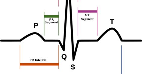 ECG MATLAB code Simulation m file - MATLAB Programming