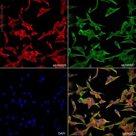 Alexa Fluor® 647 Anti-NSE antibody [EPR3377] (ab199829) | Abcam