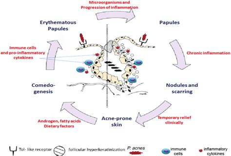 Inflammatory mechanisms involved in different stages of acne vulgaris ...