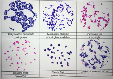 Staphylococcus Epidermidis Gram Stain