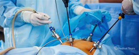 Laparoscopic Surgery, Procedure and Best Hospitals in India