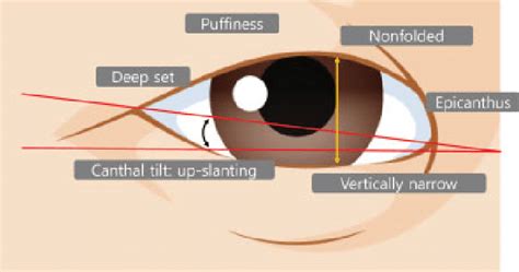 Palpebral Fissure Anatomy