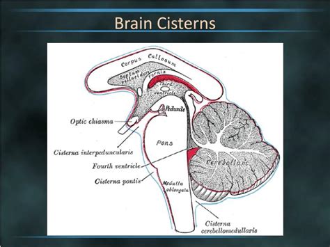 PPT - Brain Cisterns PowerPoint Presentation - ID:2263744