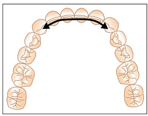 Principle 9 Establish Ideal Arch Form | Pocket Dentistry