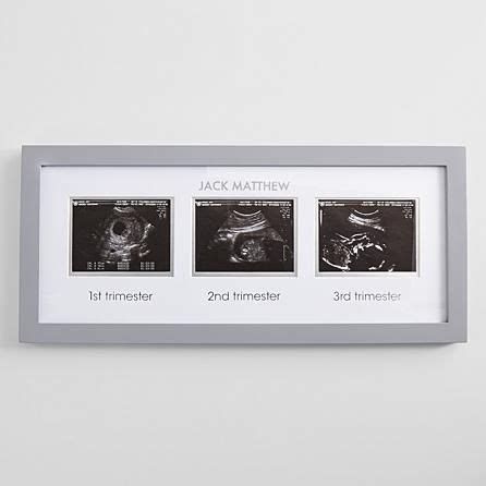 First Photo Shoot Sonogram Frame | Sonogram frame, Baby ultrasound ...