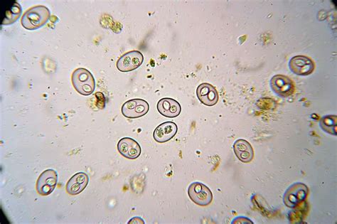 Coccidia at 400%. Very common in this area. | Medical laboratory ...