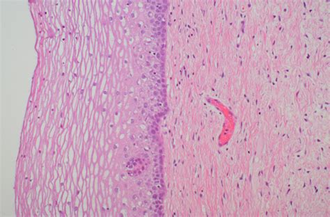 Pathology Outlines - Histology (normal)