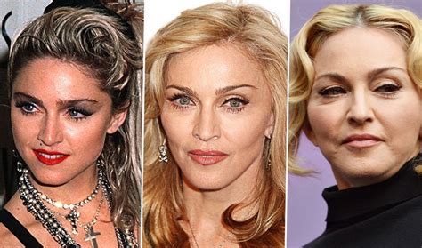 Celebrity Madonna - plastic surgery, photos, video