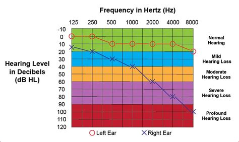 Hearing Tests | Audiometry and Audiogram | Colorado | UCHealth