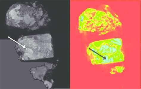 Three-dimensional reconstruction of a bone biopsy sample containing ...