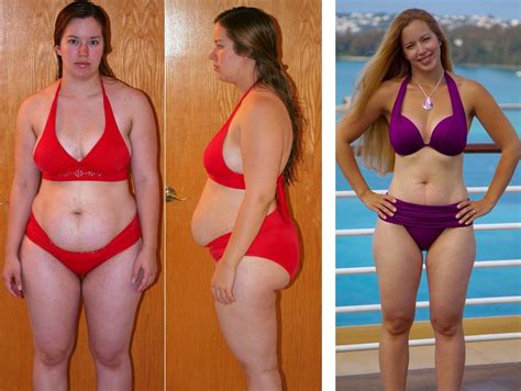 Weight Loss success stories