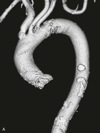 Cross-Sectional Imaging Techniques | Radiology Key