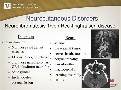 PPT - Neurocutaneous Disorders PowerPoint Presentation, free download - ID:4501574