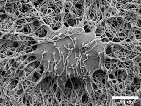 Contributions of Resin Cast Etching to Visualising the Osteocyte Lacuno-Canalicular Network ...