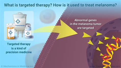 Slide Show - Treating Melanoma