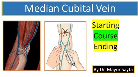 Median Cubital Vein - YouTube