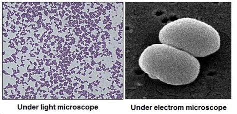 Morphology of S. epidermidis cells. Sources:... | Download Scientific ...