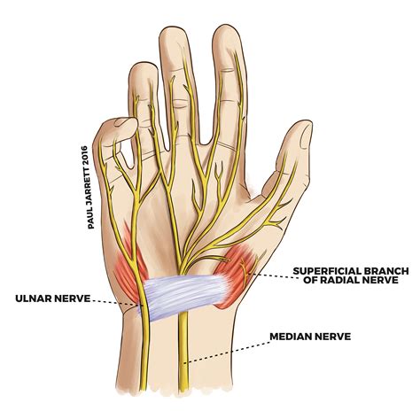 Hand and Wrist Anatomy | Murdoch Orthopaedic Clinic