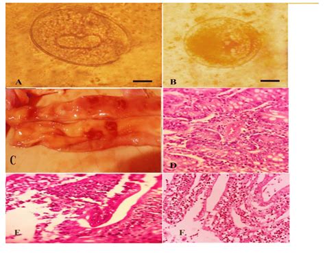 Photo (1) A: Blantidium coli trophozoite. B: B. coli cyst. (Scale ...