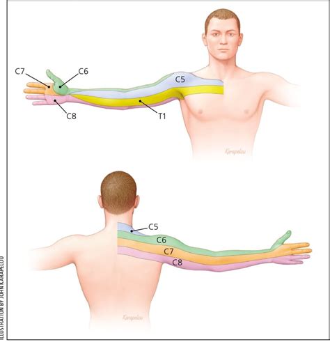 C5 Nerve Root Dermatome - Dermatomes Chart and Map