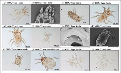 Figure 2 from Isolation and identification of mites associated with raw ...