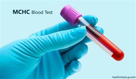 MCHC Blood Test | Symptoms, Causes of Low and High MCHC