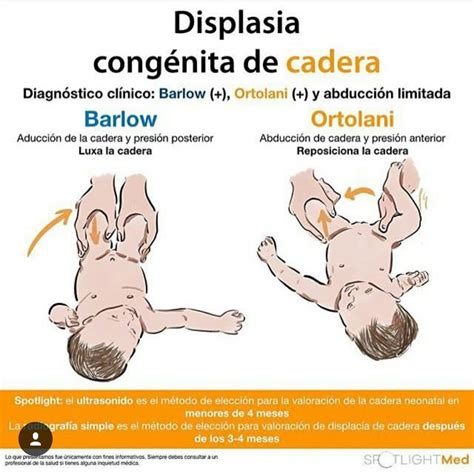 Displasia de cadera | Enfermería pediátrica, Enfermería neonatal, Obstetricia