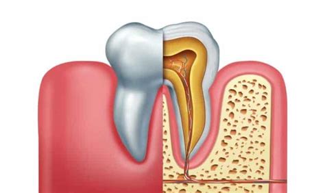 4 Common Symptoms That You Might Have A Root Canal Infection