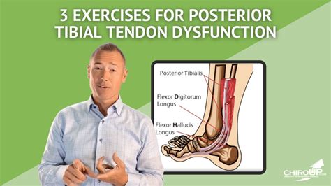 Anterior Tibial Tendonitis Exercises | SexiezPicz Web Porn