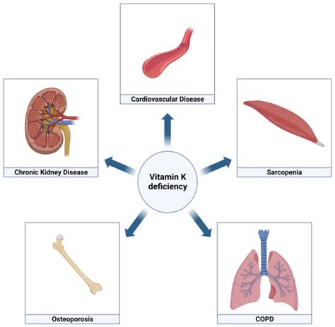 Vitamin K Deficiency