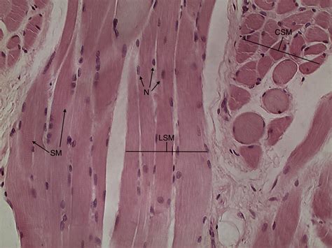 Skeletal Muscle Slide 400x