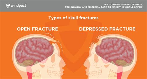 Sensitivity Analysis of Skull Fractures in the Human Head