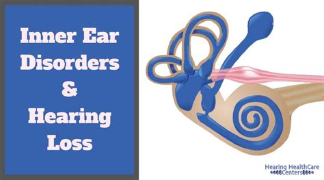 Inner Ear Disorders and Hearing Loss - Hearing HealthCare Centers