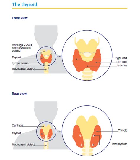 Understanding Thyroid Cancer: Symptoms, Types, and Risk Factors - Cancer Council Victoria ...