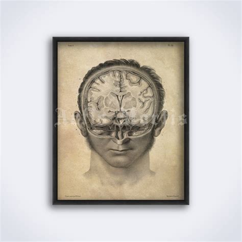 Human Brain Cross-section Anatomy Illustration Vintage Medical Art, Neurology Print, Poster ...