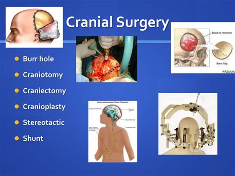 PPT - Acute Intracranial Problems PowerPoint Presentation, free ...