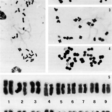 -Chromosome numbers and karyotypes. Taxa Chromosome Karyotypes Numbers ...