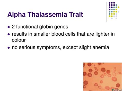 PPT - Thalassemia & Treatment PowerPoint Presentation, free download - ID:6651132