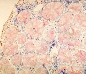 Purkinje Fibers in the Moderator Band. Cross Section. – Collection of Histology Images