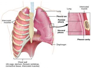 Hemothorax - WikEM