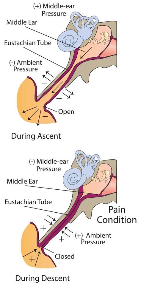 Middle-Ear Equalization | Ears & Diving - DAN Health Issues & Diving ...