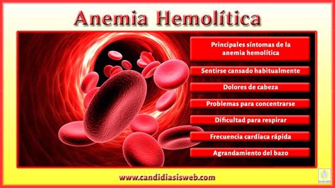 Anemia Hemolitica Causas Sintomas E Tratamentos Dicas De Musculacao ...