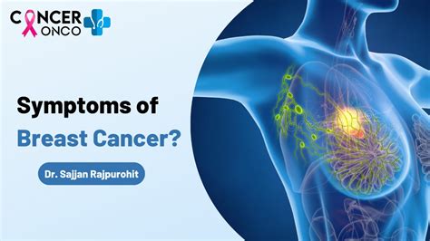 What are the Symptoms of Breast Cancer