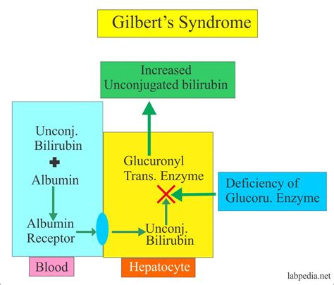 gill bar syndrome – excès de bilirubine symptômes – Kuchi