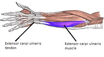 Extensor Carpi Ulnaris Tendinitis: Symptoms & Treatment | Study.com